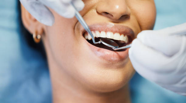 Best Emergency Treatment for Dental Infections or Abscesses in Sardis, MS